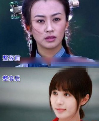 李菲兒