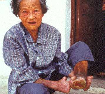李恆英