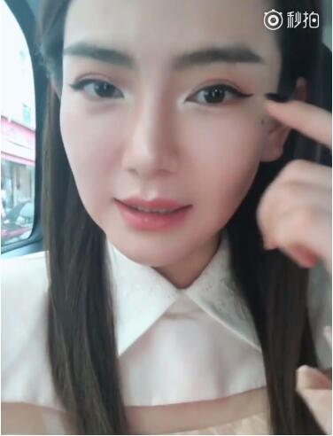 戚薇