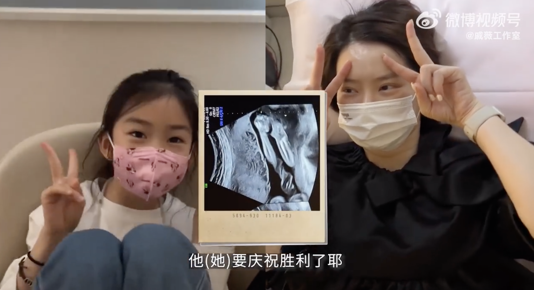 戚薇