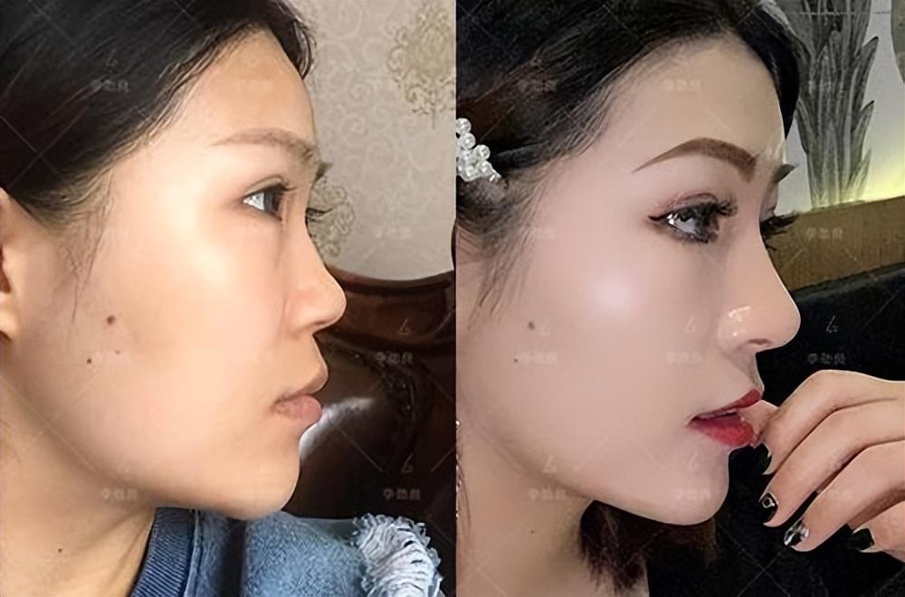 李一桐