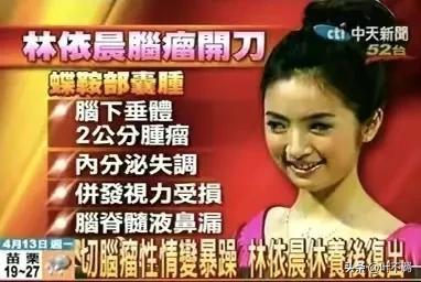 林依晨