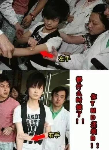 李宇春