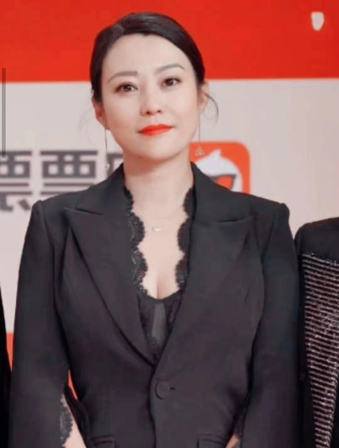 郝蕾